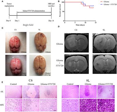 FTY720 Exerts Anti-Glioma Effects by Regulating the Glioma Microenvironment Through Increased CXCR4 Internalization by Glioma-Associated Microglia